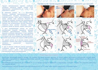 Буклет з інфосерії "Здоровеньке малятко": "Грудне вигодовування" Б